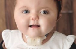 smiling portrait of a young girl with a tracheostomy