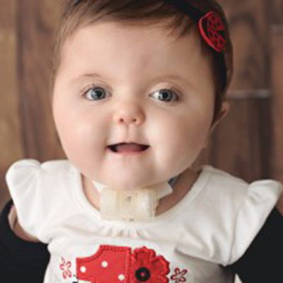 smiling portrait of a young girl with a tracheostomy