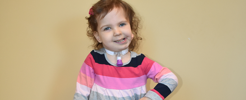 A little girl with a tracheostomy and craniofacial difference smiles