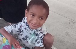 Dominic, a young dark-skinned boy with a tracheostomy, looks up and smiles while sitting on a bench